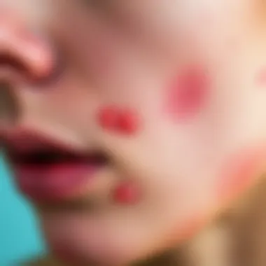 Close-up of skin affected by acne after a workout session, highlighting the impact of exercise